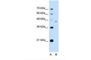 Image no. 1 for anti-FIC Domain Containing (FICD) (AA 351-400) antibody (ABIN321159) (FICD antibody  (AA 351-400))