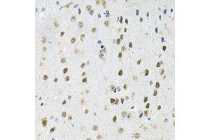 Immunohistochemistry of paraffin-embedded mouse brain using PPP1CA antibody. (PPP1CA antibody  (AA 1-330))