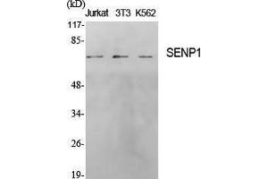 Western Blotting (WB) image for anti-SUMO1/sentrin Specific Peptidase 1 (SENP1) (N-Term) antibody (ABIN3186898) (SENP1 antibody  (N-Term))