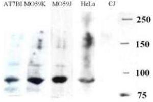 Western blotting. (DCLRE1C antibody  (AA 482-495))