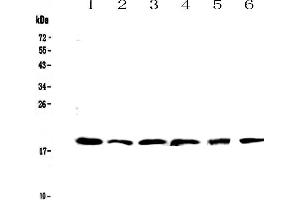 Western blot analysis of IL10 using anti-IL10 antibody . (IL-10 antibody  (AA 19-178))