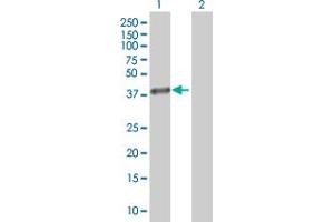 Western Blotting (WB) image for AKR1B1 293T Cell Transient Overexpression Lysate(Denatured) (ABIN1330882)