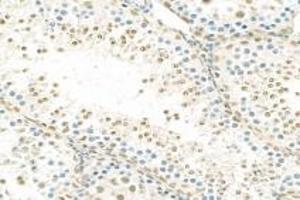 Immunohistochemistry analysis of paraffin-embedded rat testis using,RPAP2 (ABIN7075481) at dilution of 1: 1000 (RPAP2 antibody)