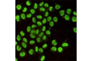 Immunofluorescent analysis of Hela cells using Ku80 mouse mAb (1:400). (XRCC5 antibody)