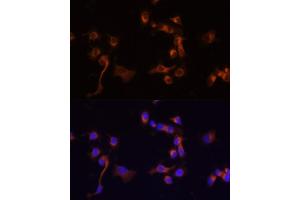 Immunofluorescence (IF) image for anti-C-Abl Oncogene 1, Non-Receptor tyrosine Kinase (ABL1) (AA 490-590) antibody (ABIN3020872)
