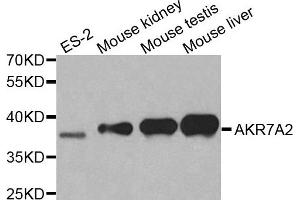 Western blot analysis of extracts of various cell lines, using AKR7A2 antibody. (AKR7A2 antibody  (AA 100-359))
