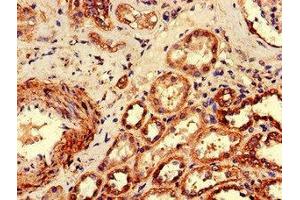 Immunohistochemistry of paraffin-embedded human kidney tissue using ABIN7174788 at dilution of 1:100 (C1ORF189 antibody  (AA 1-101))