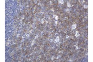 Image no. 1 for anti-Mucin 16, Cell Surface Associated (CA125) (AA 10329-10628) antibody (ABIN1490811) (MUC16 antibody  (AA 10329-10628))