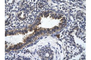 Rabbit Anti-ZFR Antibody       Paraffin Embedded Tissue:  Human bronchiole epithelium   Cellular Data:  Epithelial cells of renal tubule  Antibody Concentration:   4. (ZFR antibody  (Middle Region))