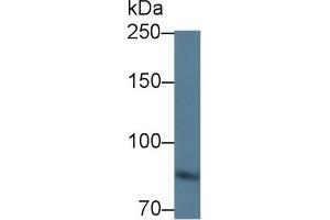 Detection of ITGb6 in Mouse Kidney lysate using Polyclonal Antibody to Integrin Beta 6 (ITGb6) (ITGB6 antibody  (AA 131-619))