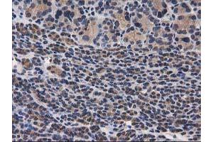 Image no. 16 for anti-Destrin (Actin Depolymerizing Factor) (DSTN) antibody (ABIN1497910) (Destrin antibody)