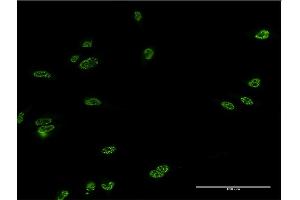 Immunofluorescence of monoclonal antibody to LHX4 on HeLa cell. (LHX4 antibody  (AA 291-390))
