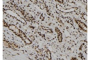 ABIN6273186 at 1/100 staining Human kidney tissue by IHC-P. (WDR46 antibody  (Internal Region))