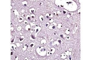 Immunohistochemistry (IHC) image for anti-Lipoprotein Lipase (LPL) (AA 300-327) antibody (ABIN3031635)