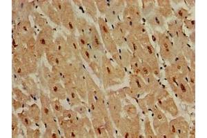 Immunohistochemistry of paraffin-embedded human heart tissue using ABIN7150025 at dilution of 1:100 (DDR2 antibody  (AA 447-540))