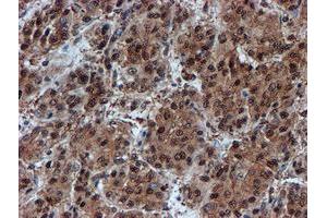 Image no. 2 for anti-Proteasome Subunit alpha 6 (PSMA6) antibody (ABIN1500464) (PSMA6 antibody)
