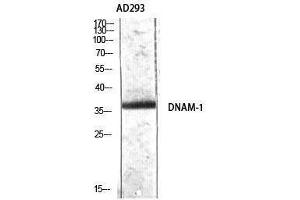 Western Blotting (WB) image for anti-CD226 (CD226) (Tyr570) antibody (ABIN3174791) (CD226 antibody  (Tyr570))