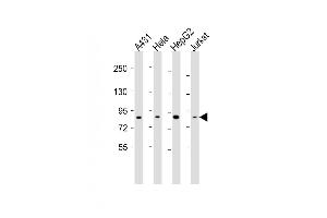 All lanes : Anti-NEK10 Antibody (Center) at 1:2000 dilution Lane 1: A431 whole cell lysates Lane 2: Hela whole cell lysates Lane 3: HepG2 whole cell lysates Lane 4: Jurkat whole cell lysates Lysates/proteins at 20 μg per lane. (NEK10 antibody  (AA 450-483))