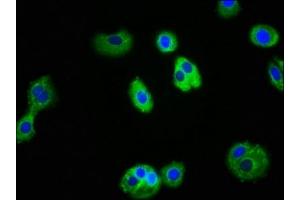 Immunofluorescence staining of HepG2 cells with ABIN7156745 at 1:100, counter-stained with DAPI. (IL1R1 antibody  (AA 18-320))