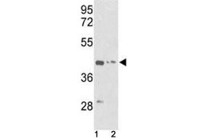 Western Blotting (WB) image for anti-Actin, gamma 1 (ACTG1) (AA 188-215) antibody (ABIN3029799)