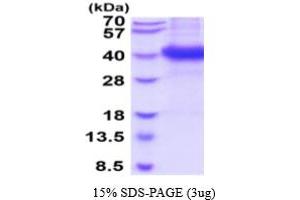 SDS-PAGE (SDS) image for neonatal Fc Receptor (FcRn) (AA 22-297) protein (His tag) (ABIN5854760) (FcRn Protein (AA 22-297) (His tag))