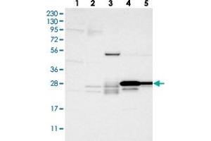 Western blot analysis of Lane 1: RT-4, Lane 2: U-251 MG, Lane 3: Human Plasma, Lane 4: Liver, Lane 5: Tonsil with PEBP4 polyclonal antibody . (PEBP4 antibody)