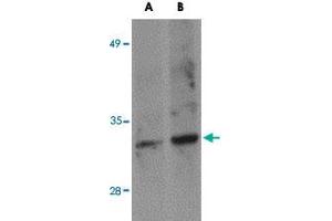 Western blot analysis of SKA1 in A-549 NE cell lysate with SKA1 polyclonal antibody  at (A) 0. (SKA1 antibody  (C-Term))