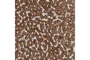 Immunohistochemical staining of human liver with ARSD polyclonal antibody  shows strong cytoplasmic positivity with a granular pattern in hepatocytes. (Arylsulfatase D antibody)