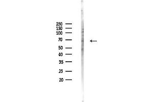 anti-Solute Carrier Family 22 (Organic Cation Transporter), Member 14 (SLC22A14) antibody