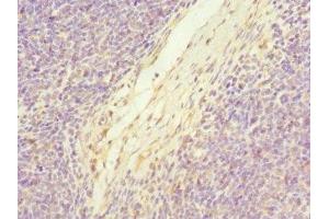 Immunohistochemistry of paraffin-embedded human thymus tissue using ABIN7174771 at dilution of 1:100 (C19orf48 antibody  (AA 1-117))