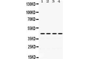 Western Blotting (WB) image for anti-Actin, alpha 1, Skeletal Muscle (ACTA1) (AA 277-308), (C-Term) antibody (ABIN3043519) (Actin antibody  (C-Term))