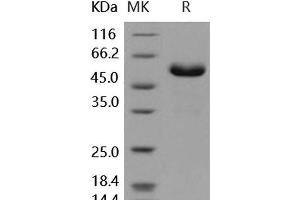 Western Blotting (WB) image for Fc Fragment of IgG, Low Affinity IIa, Receptor (CD32) (FCGR2A) (Active) protein (Fc Tag) (ABIN7195676) (FCGR2A Protein (Fc Tag))