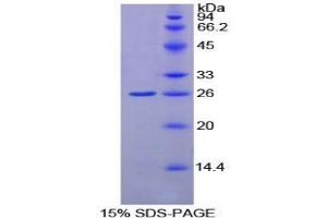 SDS-PAGE analysis of Rat GSTk1 Protein.