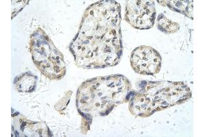 Rabbit Anti-PPARD antibody        Paraffin Embedded Tissue:  Human Placenta cell   Cellular Data:  Epithelial cells of renal tubule  Antibody Concentration:   4. (PPARD antibody  (N-Term))