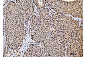IHC analysis of HOXC4 using anti-HOXC4 antibody (ABIN7603059). (HOXC4 antibody  (Middle Region))