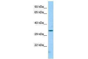 Host: Rabbit Target Name: FCGR2C Sample Type: Hela Whole cell lysates Antibody Dilution: 1.