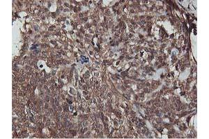 Immunohistochemistry (IHC) image for anti-V-Akt Murine Thymoma Viral Oncogene Homolog 1 (AKT1) antibody (ABIN1496556) (AKT1 antibody)