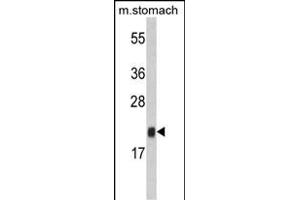 FKBP11 antibody  (N-Term)