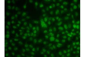 Immunofluorescence analysis of A549 cells using KLF3 antibody (ABIN5974328). (KLF3 antibody)