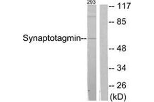 Western blot analysis of extracts from 293 cells, treated with Forskolin 40nM 30', using Synaptotagmin (Ab-309) Antibody. (Synaptotagmin antibody  (AA 276-325))