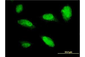 Immunofluorescence (IF) image for anti-Paired-Like Homeobox 2a (PHOX2A) (AA 1-90) antibody (ABIN559952)