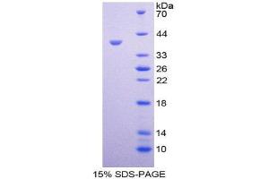 SDS-PAGE (SDS) image for Trophoblast Glycoprotein (TPBG) (AA 34-356) protein (His tag) (ABIN2127091)