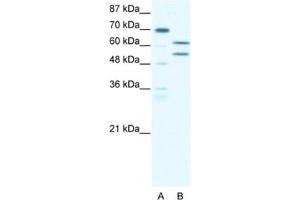 Western Blotting (WB) image for anti-Zinc Finger and BTB Domain Containing 43 (ZBTB43) antibody (ABIN2460282) (ZBTB43 antibody)