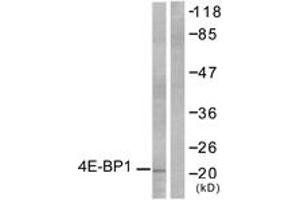Western blot analysis of extracts from MDA-MB-435 cells, treated with EGF 200ng/ml 30', using 4E-BP1 (Ab-36) Antibody. (eIF4EBP1 antibody  (AA 4-53))