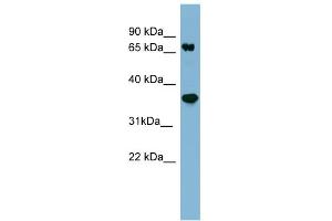 WB Suggested Anti-PPP2R1B Antibody Titration: 0. (PPP2R1B antibody  (N-Term))