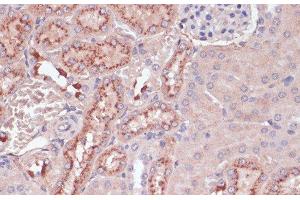 Immunohistochemistry of paraffin-embedded Mouse kidney using LYZ Polyclonal Antibody at dilution of 1:100 (40x lens). (LYZ antibody)
