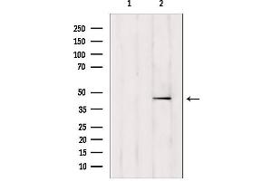 TTL antibody