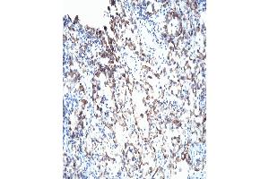 Stained with purified Mouse anti-VHL. (VHL antibody  (AA 1-213))