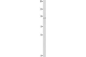 Gel: 8 % SDS-PAGE, Lysate: 40 μg, Lane: Hela cells, Primary antibody: ABIN7189583(ABCB9 Antibody) at dilution 1/250, Secondary antibody: Goat anti rabbit IgG at 1/8000 dilution, Exposure time: 1 minute (ABCB9 antibody)