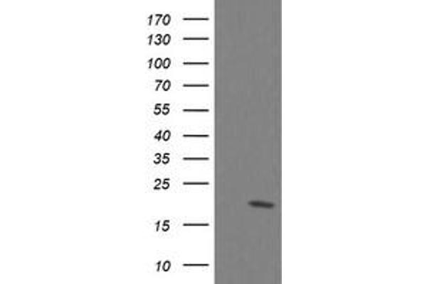 UBE2G2 antibody